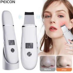 kf-S4340a517b8164bf1a7167747db54b390g-Ultrasonic-Face-Scrubber-Facial-Peeling-Skin-Scrubber-Deep-Facial-Cleaning-Spatula-Acne-Pore-Ultrasonic-Scrubber-Facial